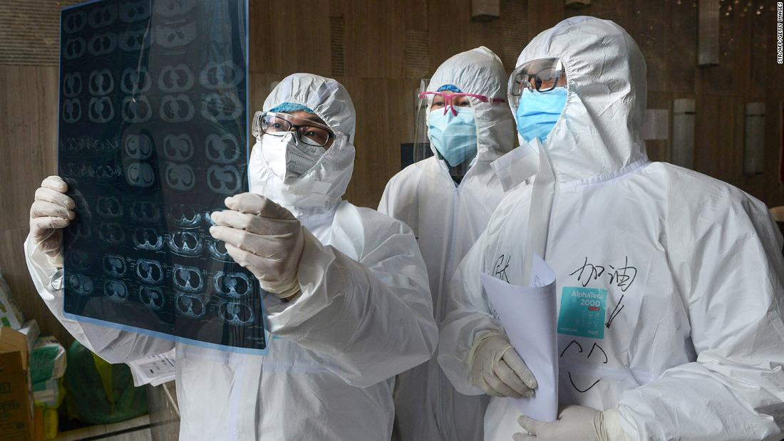 Doctors look at a CT scan of a lung at a hospital in Xiaogan, China, on February 20.